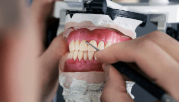 Prótesis Dentales en Cajamarca - Star Dent - Lorena Alegría